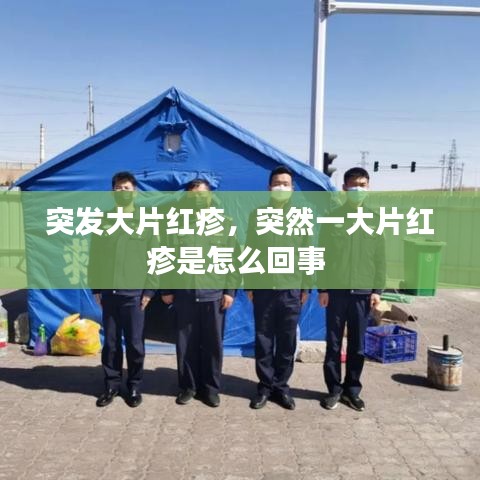 突发大片红疹，突然一大片红疹是怎么回事 