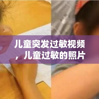 儿童突发过敏视频，儿童过敏的照片 